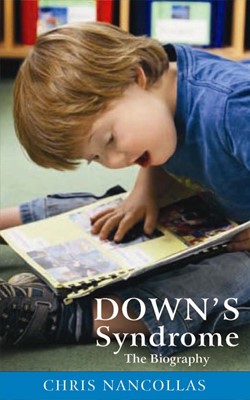Down's Syndrome (Paperback)