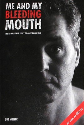 Me And My Bleeding Mouth (Paperback)