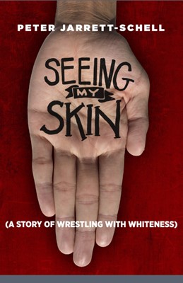 Seeing My Skin (Paperback)